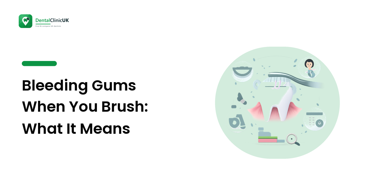 Bleeding Gums When You Brush: What It Means